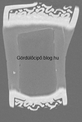 computer tomography image of rocker sole shoe